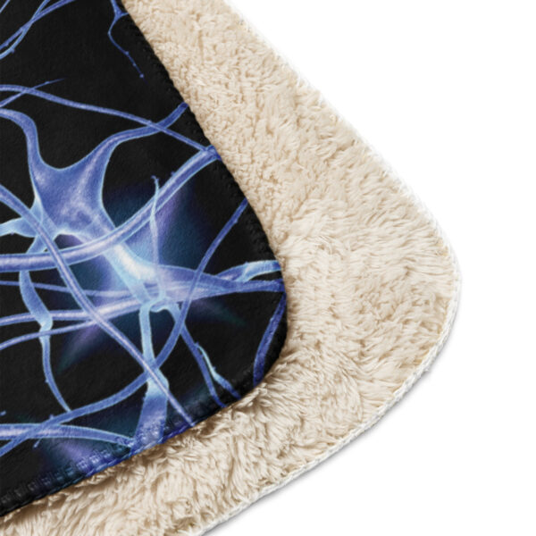 FND Australia Support Services Inc Awareness Day Merchandise Sherpa Blanket Gift for Awareness - Image 9